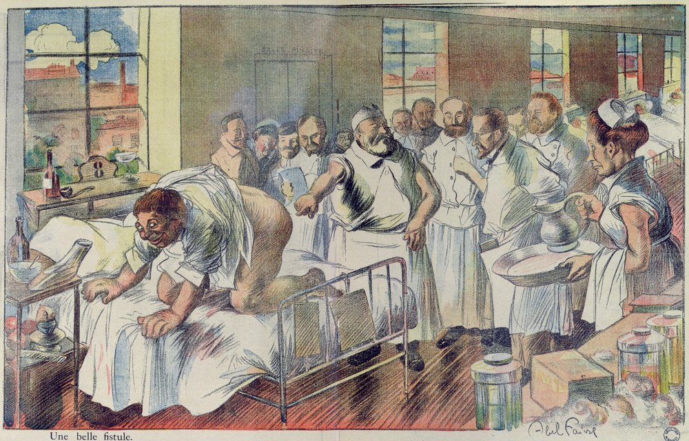 “A Beautiful Fistula”. Caricature making fun of the medical profession, cartoon from “L