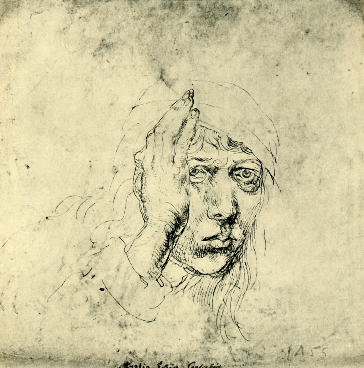 Self Portrait with a Bandage by Albrecht Dürer
