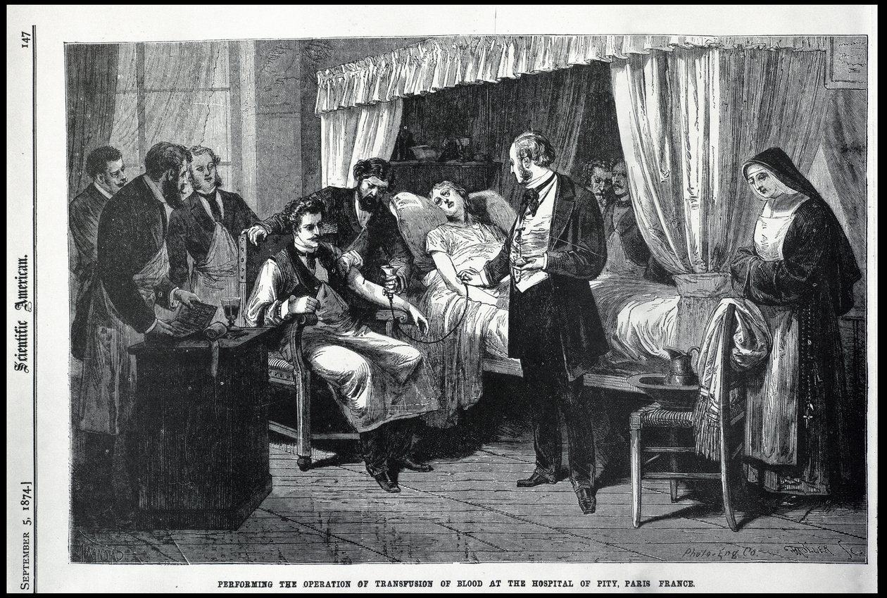 Performing the Operation of the Transfusion of Blood at the Hospital of Pity, Paris, France, illustration from the American Scientist by American School