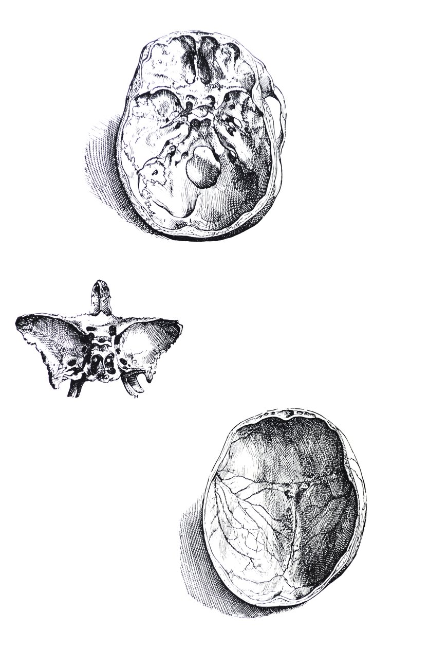The Plates from the First Book of the De Humani Corporis Fabrica by Andreas Vesalius