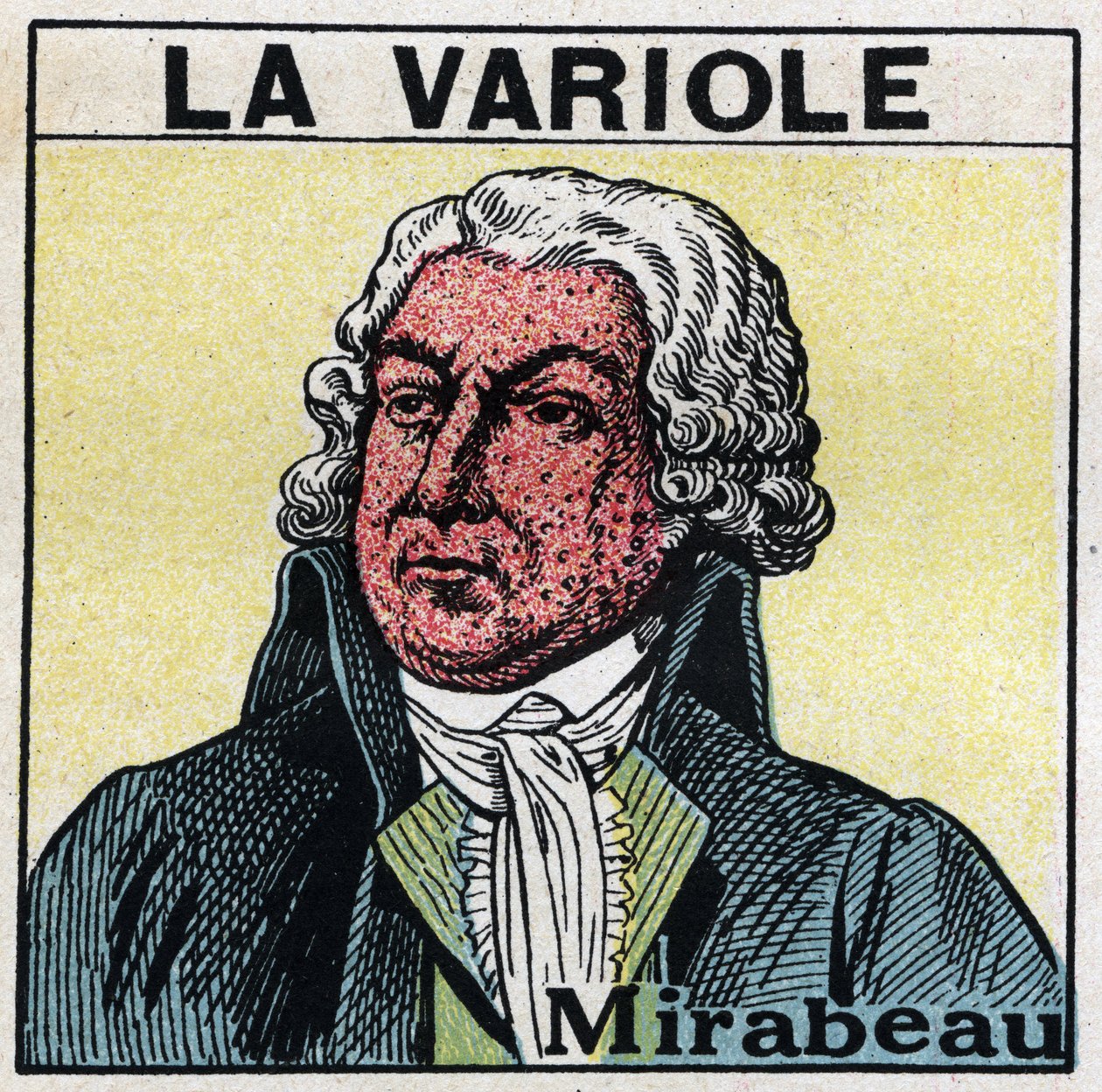 Portrait of Honore Gabriel Riqueti, Count of Mirabeau (1749-1791) with the face of figure by smallpox. To avoid scars caused by smallpox, patients should be treated in rooms or enter only red light, free of ultraviolet rays. Anonymous illustration from 192 by Anonymous Anonymous