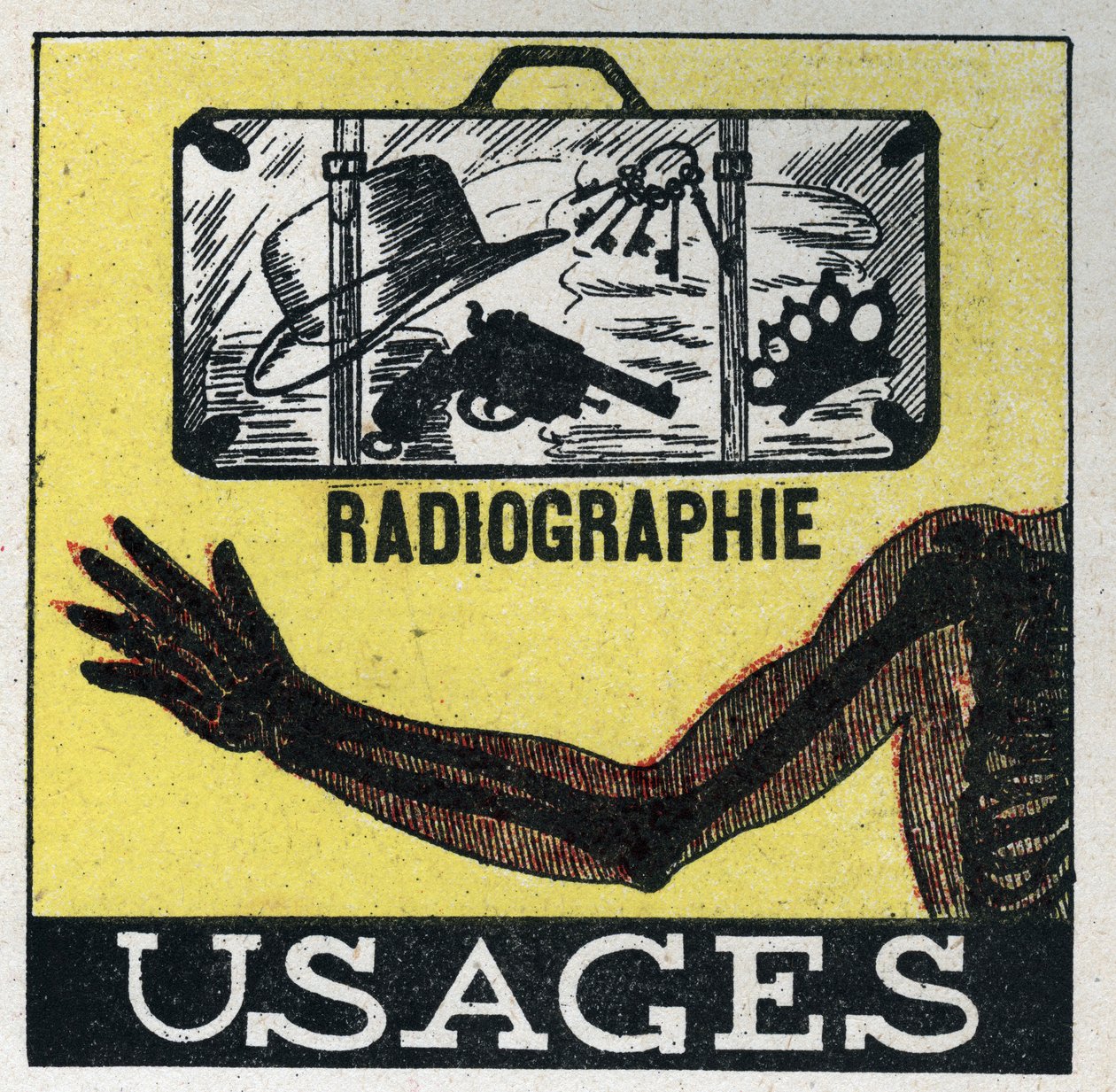 X-rays: use of X-ray to see through objects and bodies. Anonymous illustration from 1925. Private collection. by Anonymous Anonymous