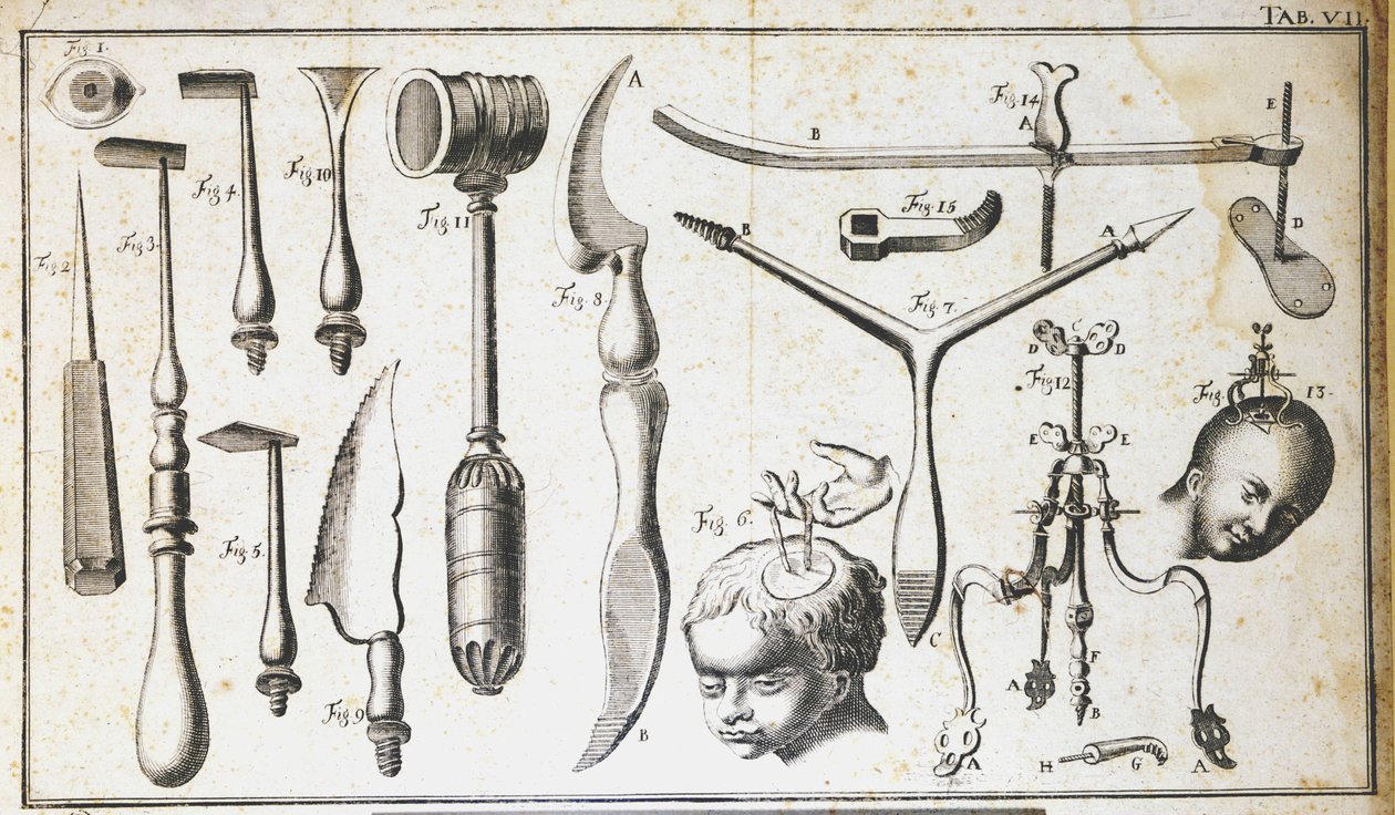 Surgical Board Representing Different Types of Surgical Instruments for Brain Removal. Engraving by Benoit Louis Prevost (1735-1809). 18th Century by Benoit Louis Prevost