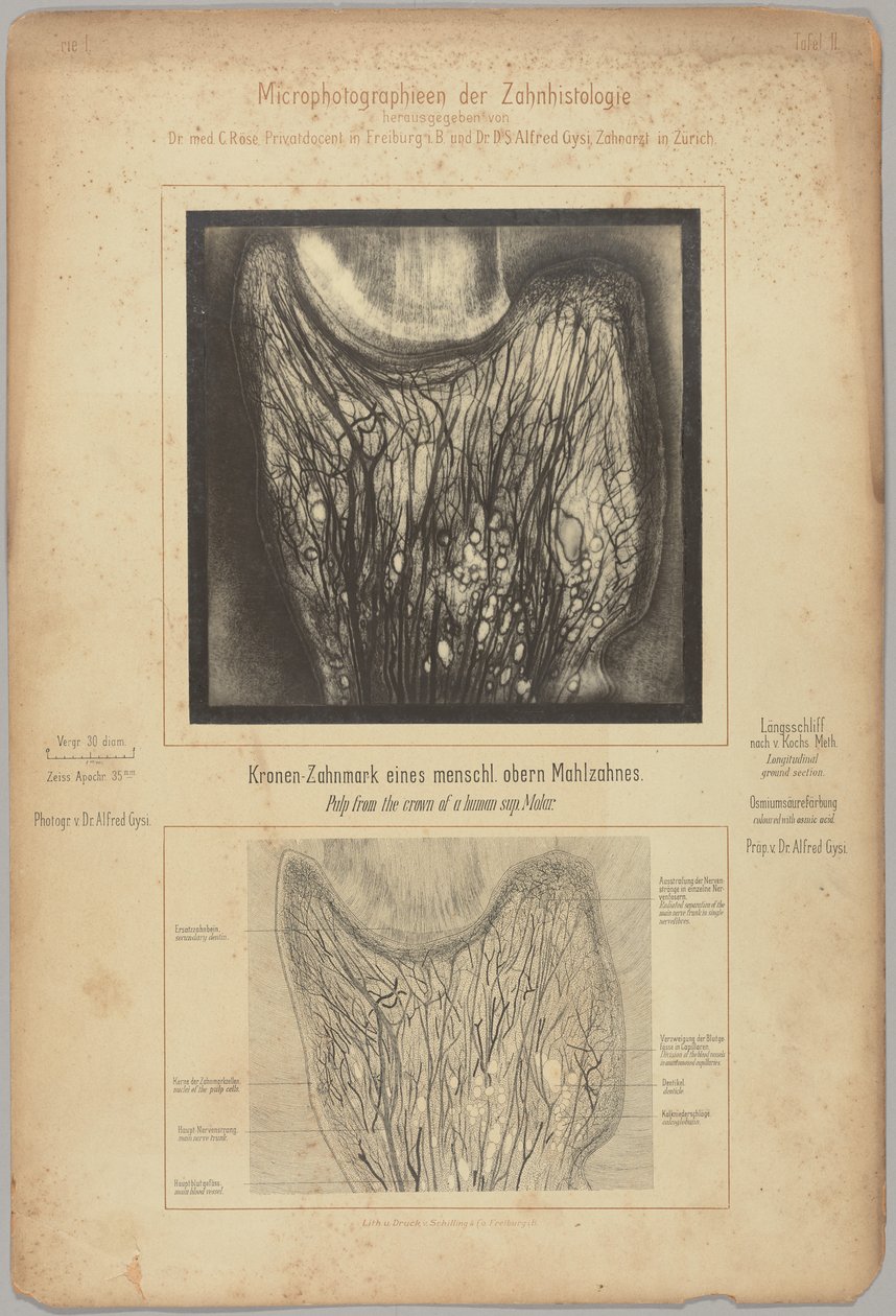 Pulp from the Crown of a Human Sup. Molar by Dr. Alfred Gysi