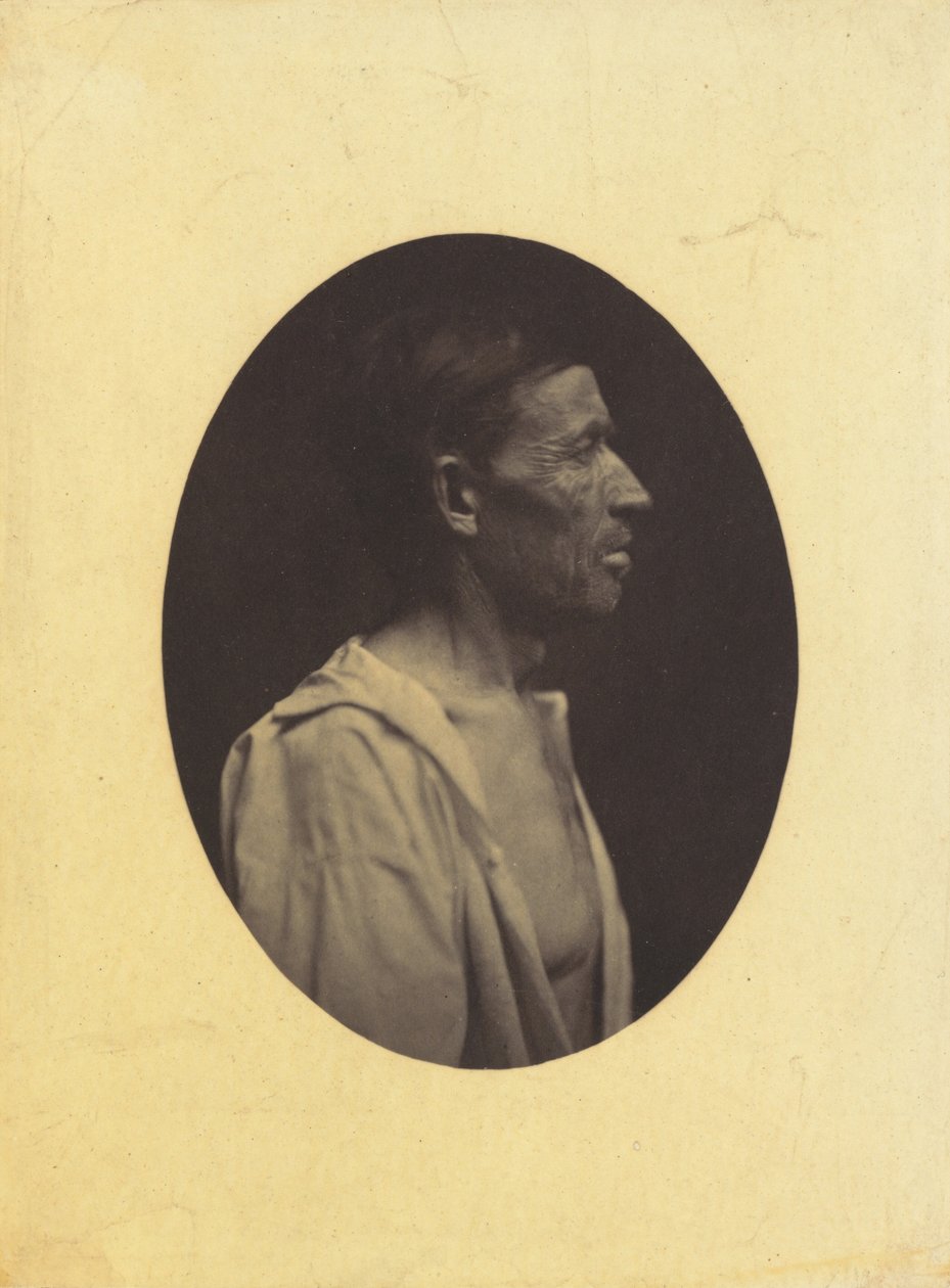 A portrait, seen in profile, of a man 42 years old, stupefied by the abuse of alcohol, 1854-1856 by Duchenne de Boulogne