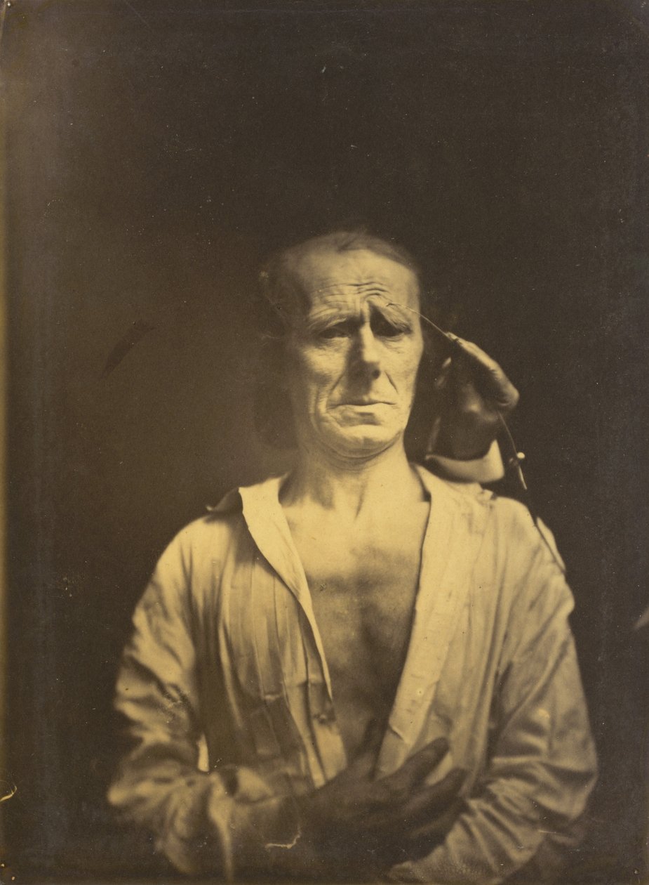 Spasm of m. corrugator supercilii under very strong light left, A relaxed face by Duchenne de Boulogne
