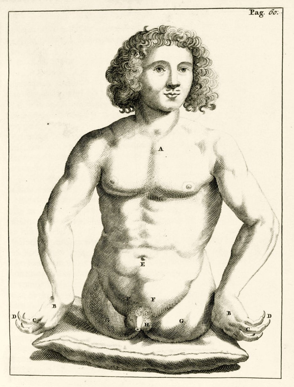 Example of congenital birth defects, from Exercitationes Practicae circa Medendi Methodum by Frederik Dekkers, 1694 by Dutch School