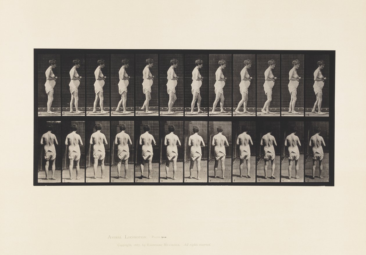 Plate 542. Multiple Cerebro-Spinal Sclerosis - Walking by Eadweard Muybridge