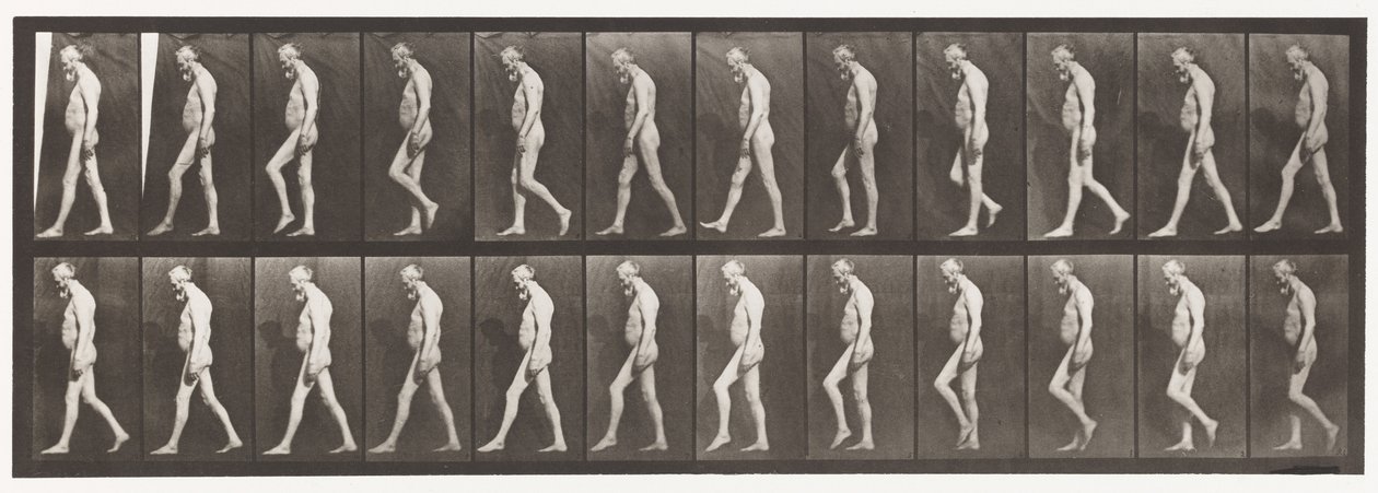 Muscular Atrophy of Legs; Adult, Walking by Eadweard Muybridge