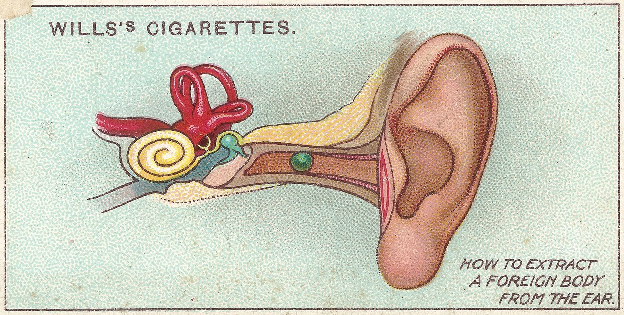 Foreign Body in Ear, no. 30 from the First Aid series of Wills cigarettes cards, 1913 by English School