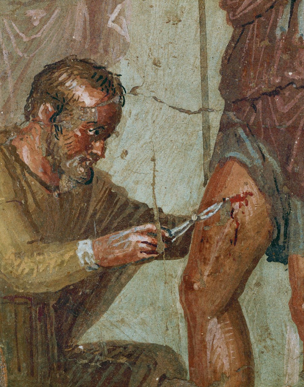 Wounded Aeneas Between Venus and Ascanius by Erich Lessing