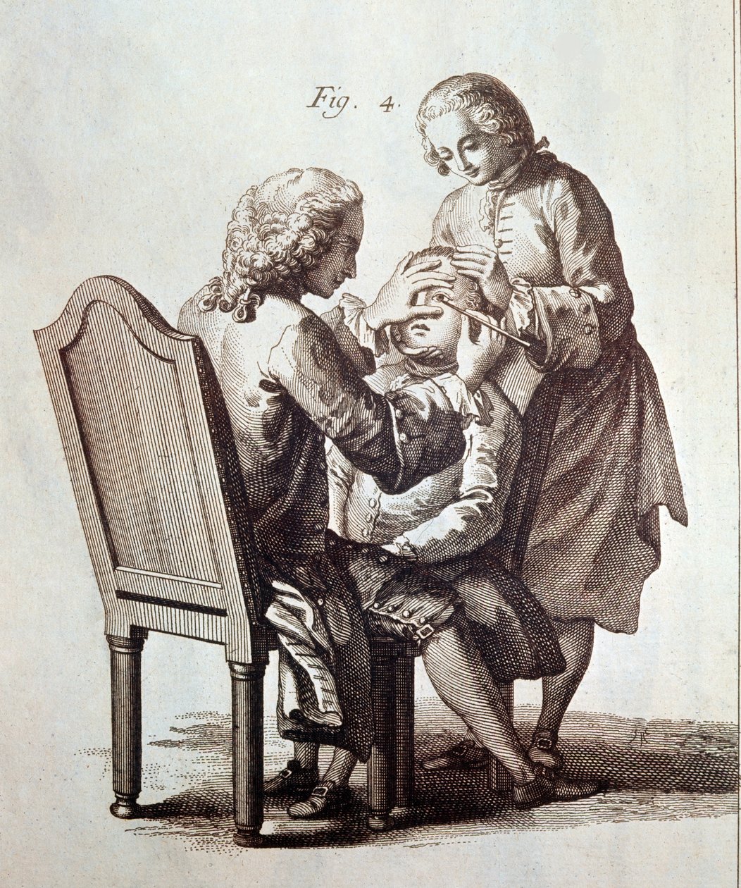 A Doctor operating on a cataract patient (illustration from the Medical Encyclopedia by Denis Diderot and Jean le Rond d