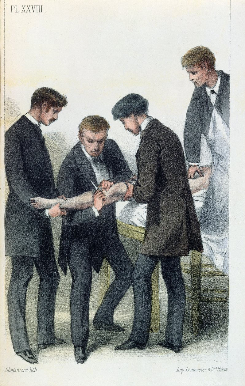 Amputating an arm, from a medical manual by Jean-Baptiste-Leon Dubreuil