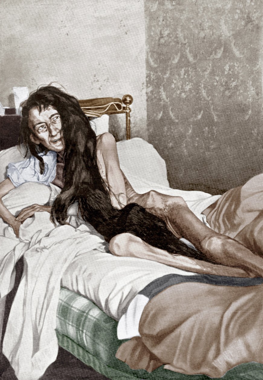 Blanche Monnier in Hospital, Poitiers, June 1901 by French School
