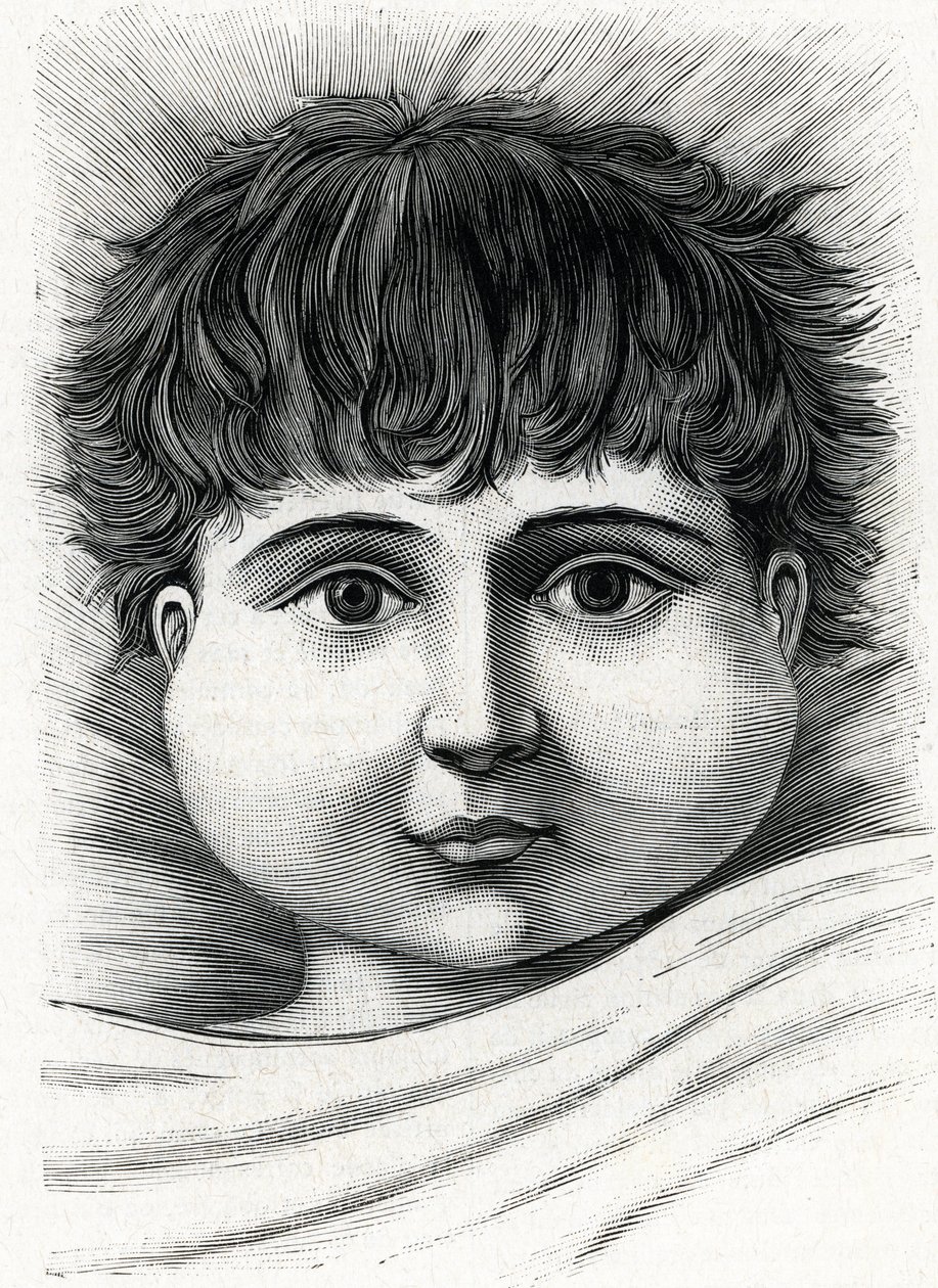 Child with mumps disease (engraving) 1888 by French School