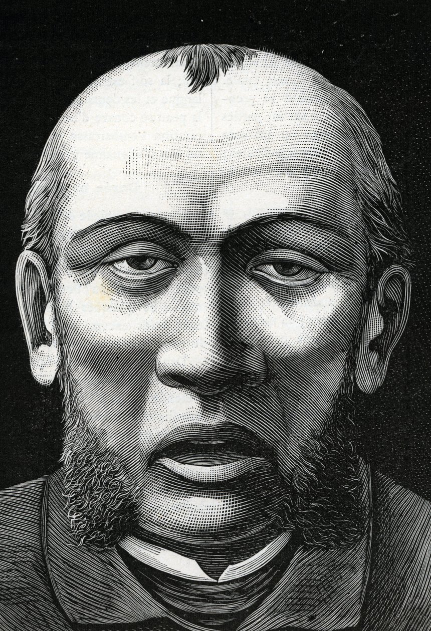 Patient with cerebral softening (engraving, 1888) by French School