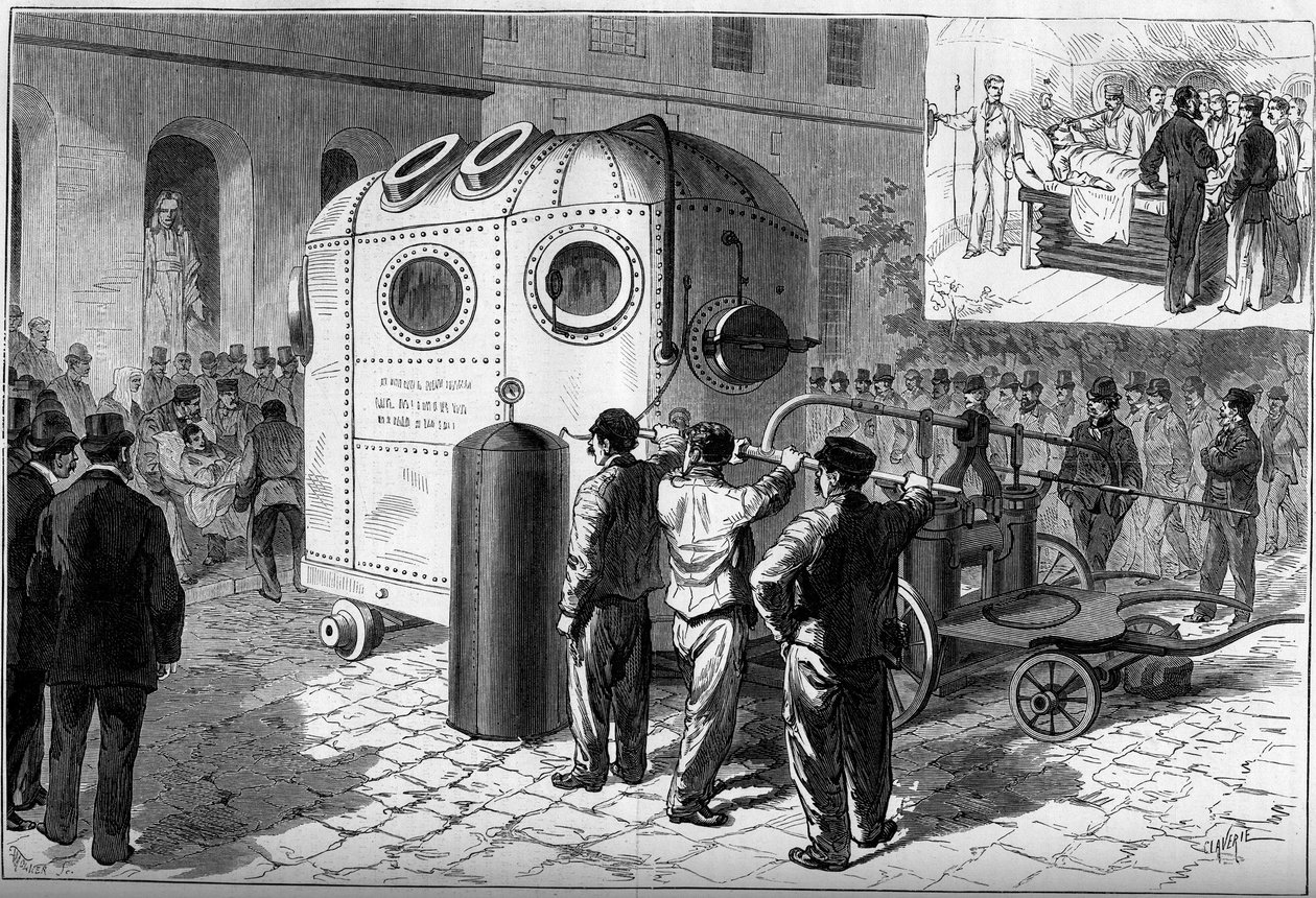 The pneumatic bell used to anesthetize patients during surgical operations by French School