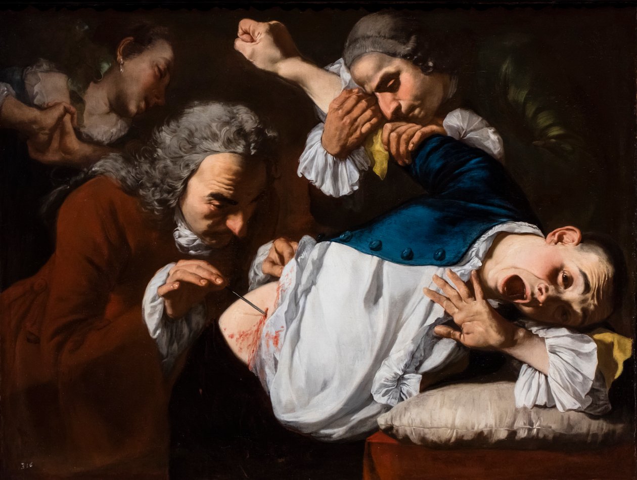 The Operation, circa 1753/54 by Gaspare Traversi