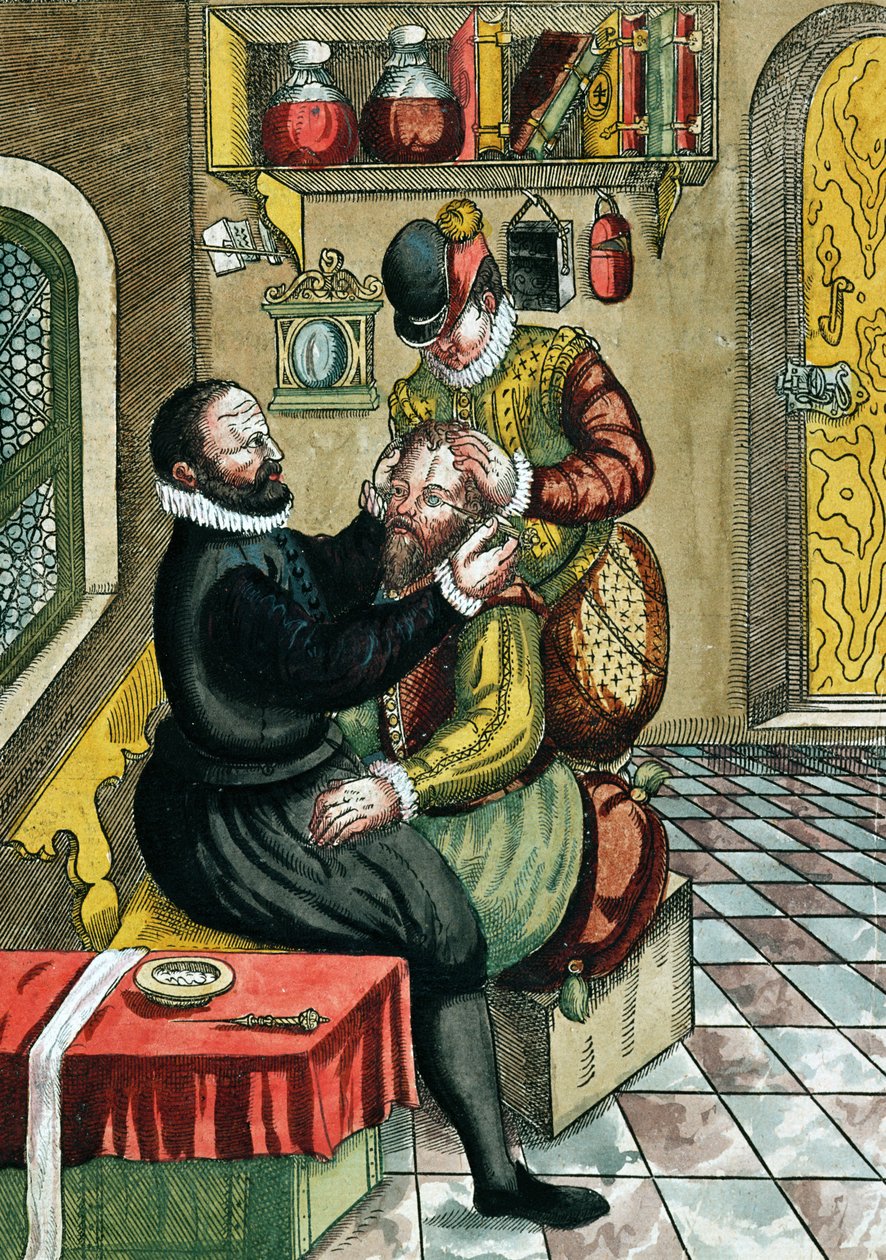 Cataract Operation, from Ophthalmodouleia by Georg Bartisch published in Dresden in 1583 by German School