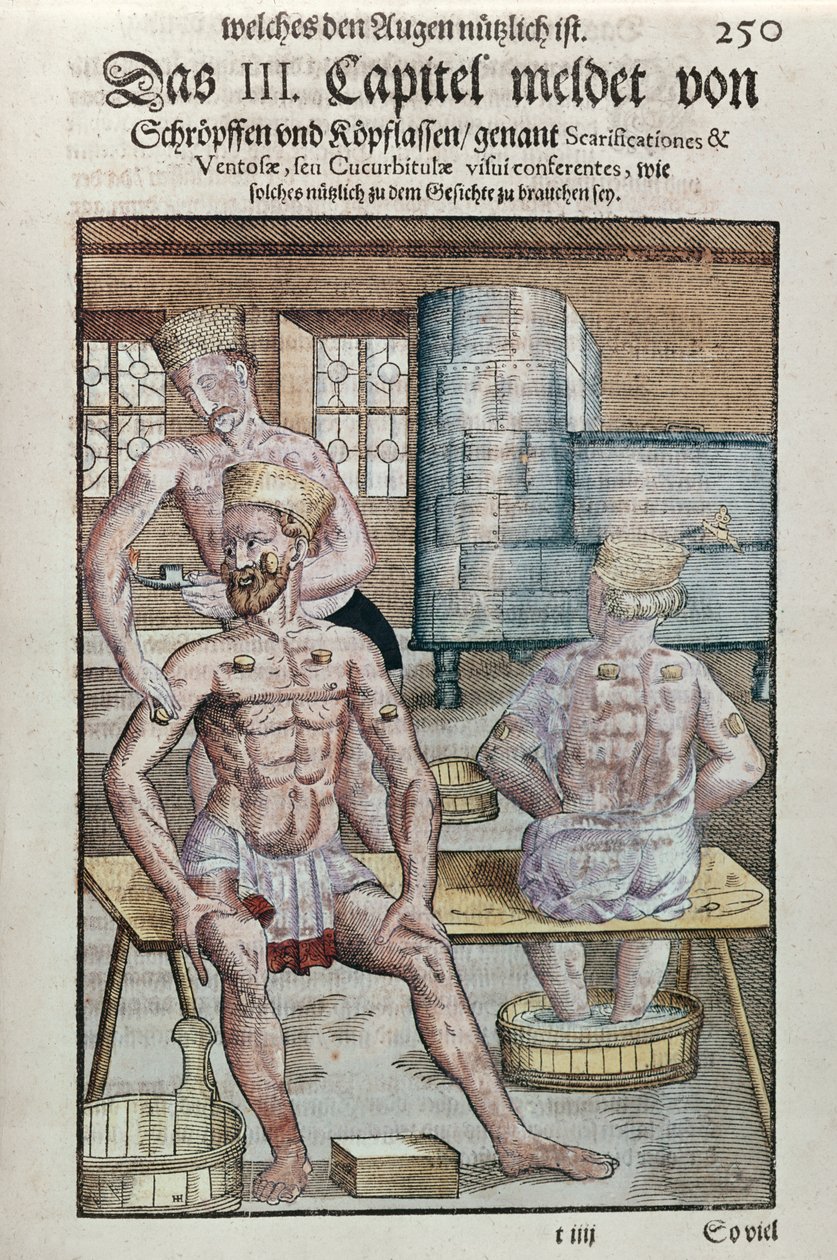 Cupping, from Ophthalmodouleia by Georg Bartisch published in Dresden in 1583 by German School