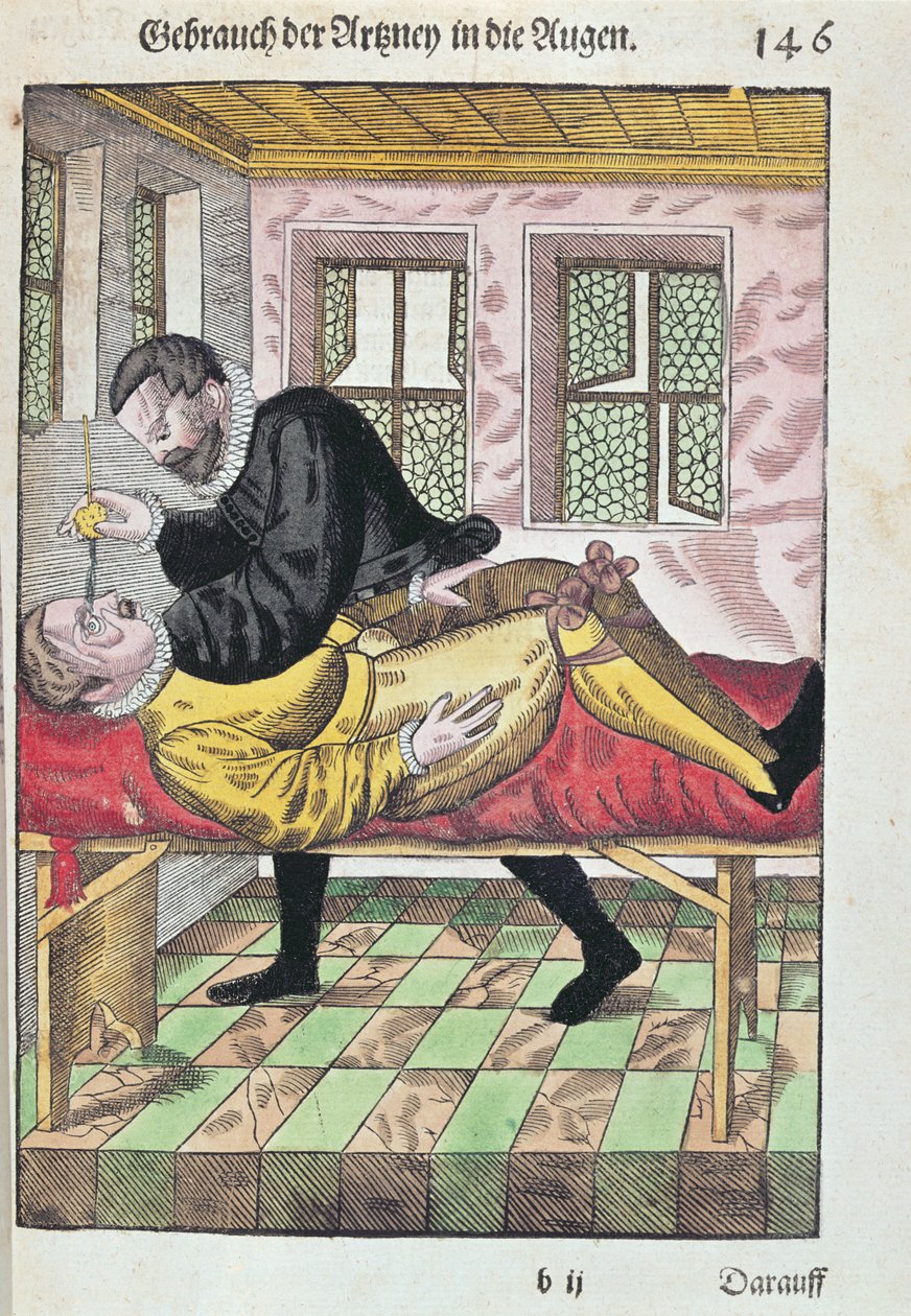 Eye Operation, from Ophthalmodouleia by Georg Bartisch published in Dresden in 1583 by German School