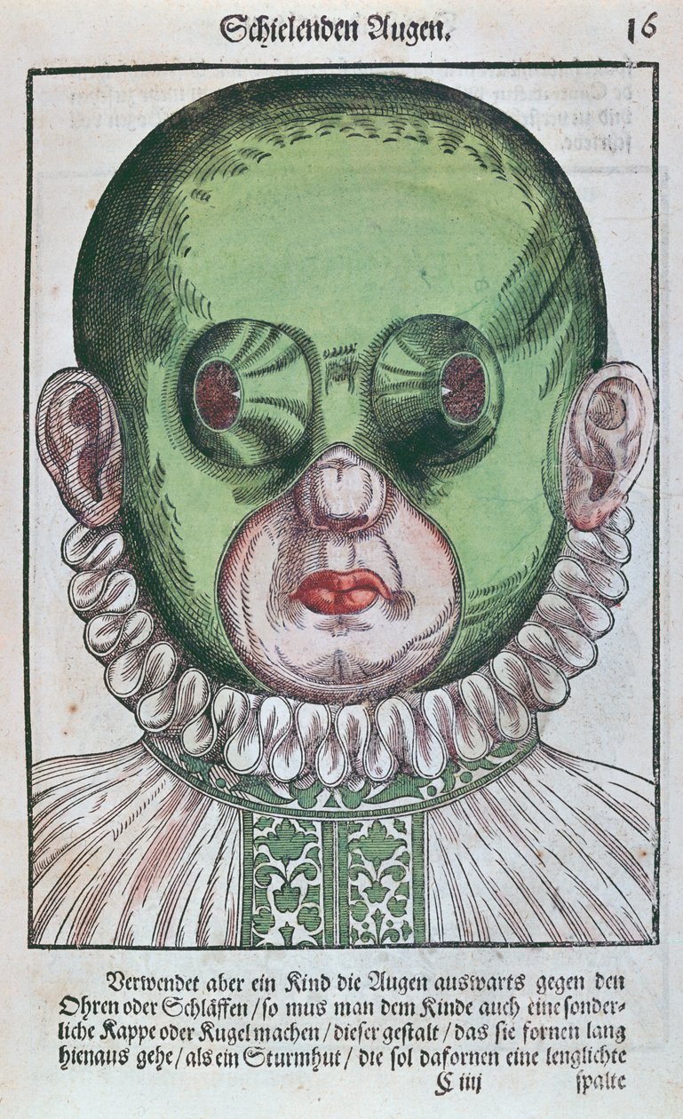 Mask for Treating a Strabismus, from Ophthalmodouleia by Georg Bartisch, published in Dresden in 1583 by German School