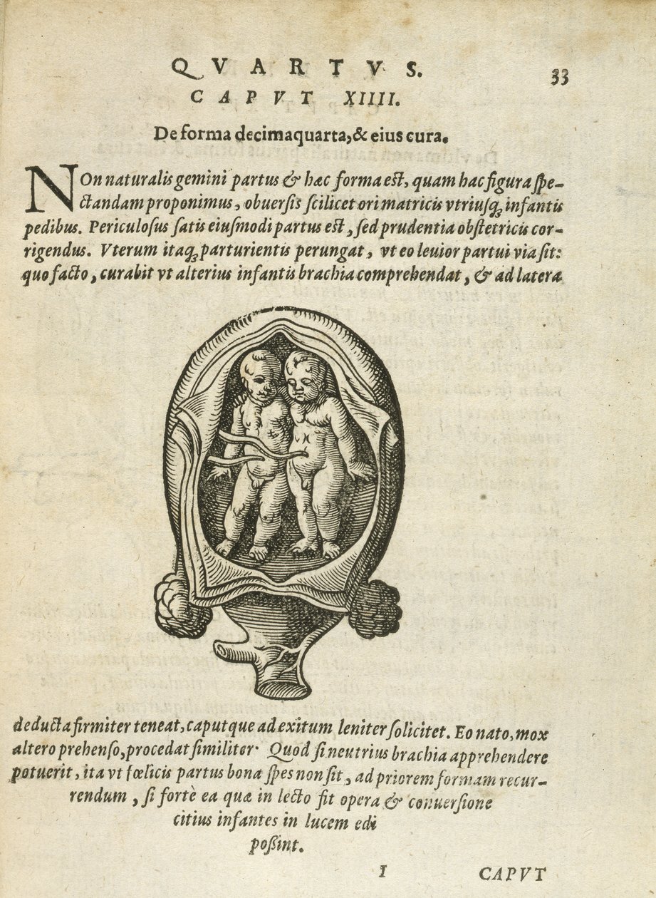 Non-Identical Twins in the Womb, Illustration from Chapter 14, Book 4 of On the Conception and Growth of Man by Rueff, 1587 by German School