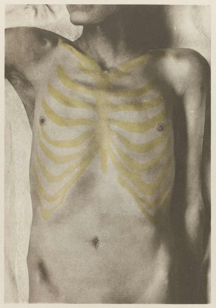 Anatomical Photo of a Male Corpse: 