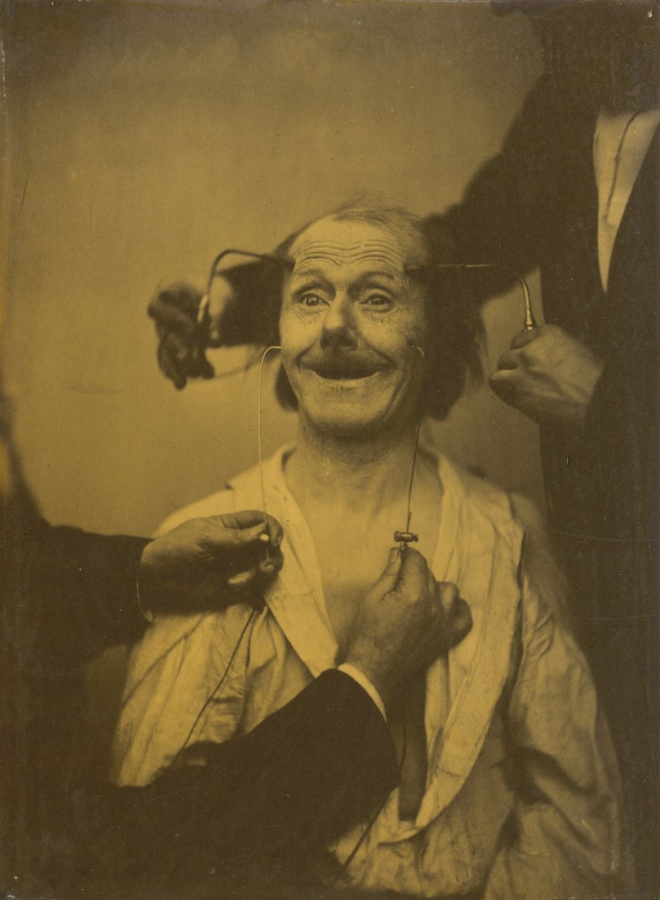 A false, incomplete expression of agreeable surprise, or admiration by Guillaume Benjamin Armand Duchenne de Boulogne