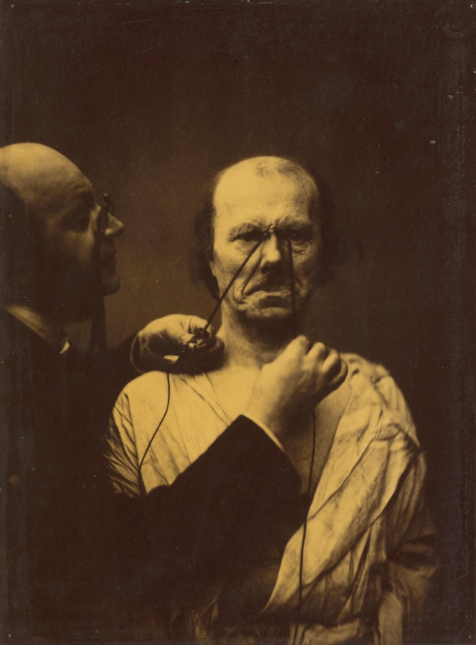 Aggression, wickedness by Guillaume-Benjamin-Armand Duchenne de Boulogne