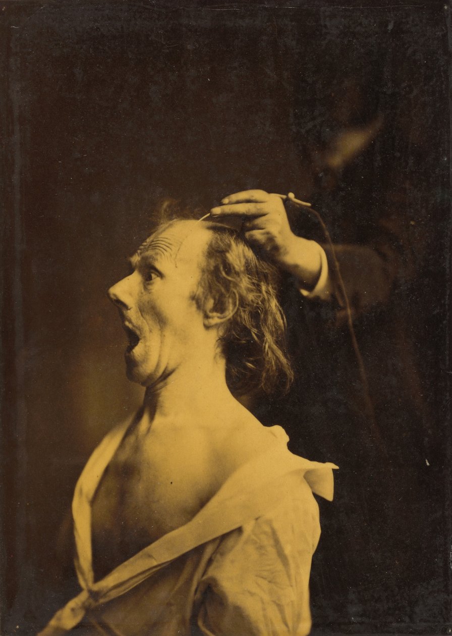 Astonishment, Stupefaction, Amazement, 1854-1856, printed 1862 by Guillaume Benjamin Armand Duchenne de Boulogne