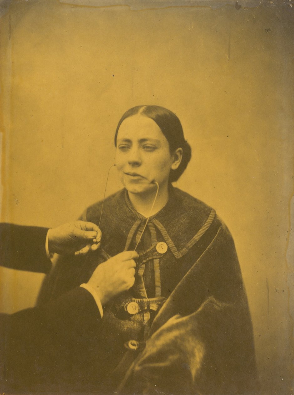 Scornful Disgust (Left); Scornful Laughter (Right), 1854-1856, Printed 1862 by Guillaume Benjamin Armand Duchenne de Boulogne