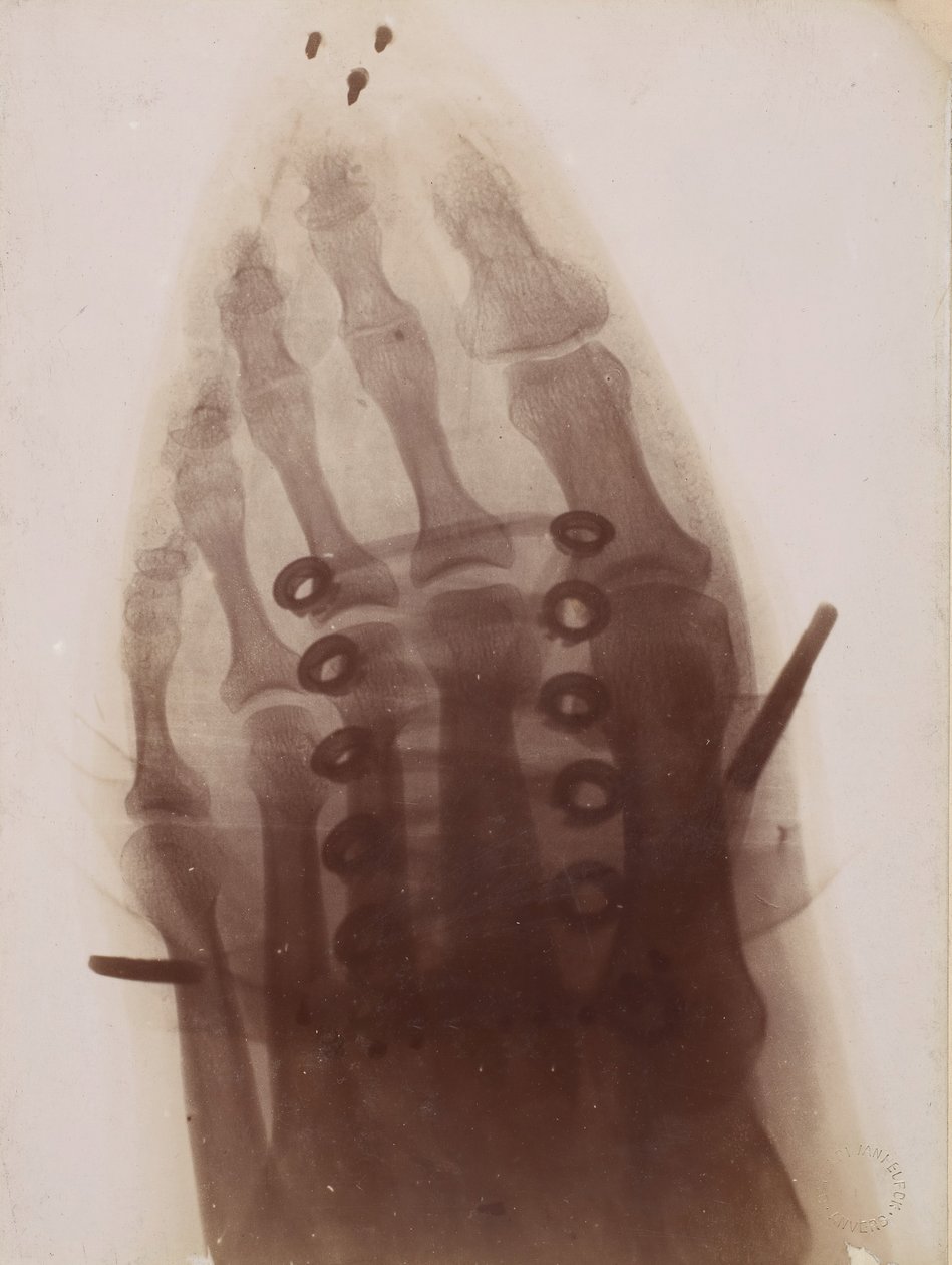 The Foot Through the Shoe by Henri van Heurck