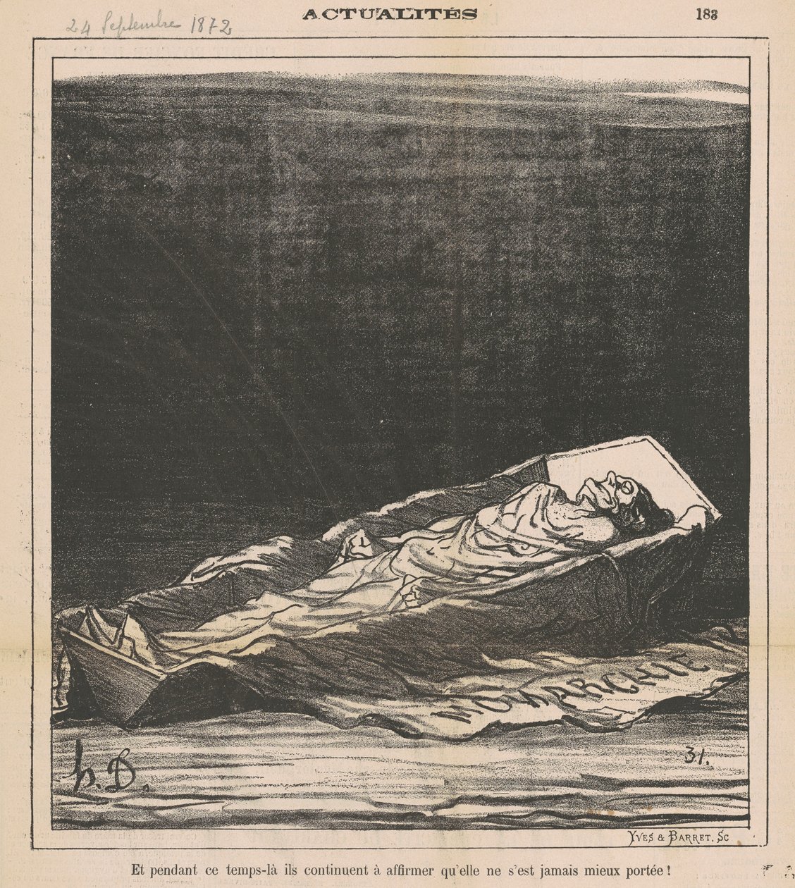 And Meanwhile They Continue to Claim That She Has Never Been Better! by Honoré Daumier