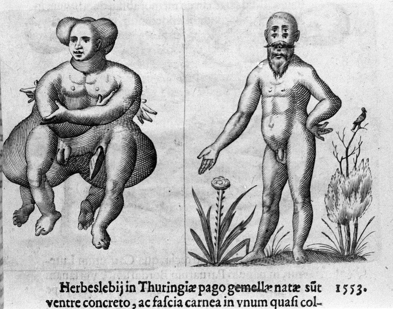 Different types of human monsters. Engraving from “De monstrorum natura, causis et differentiis” by Fortunio Liceti (1577-1656), Italian scientist. 1646 by Italian School