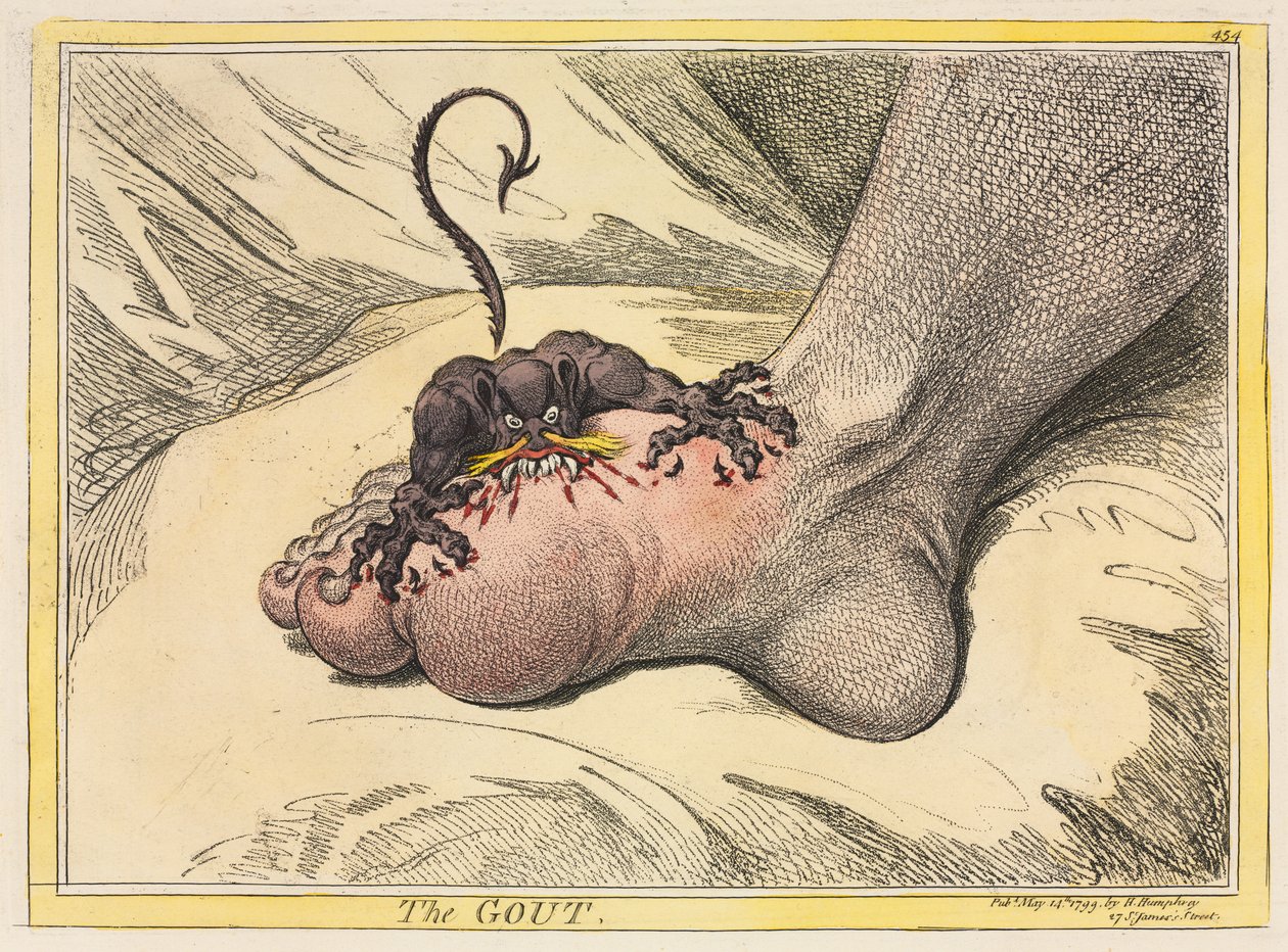 The Gout, 1799 by James Gillray