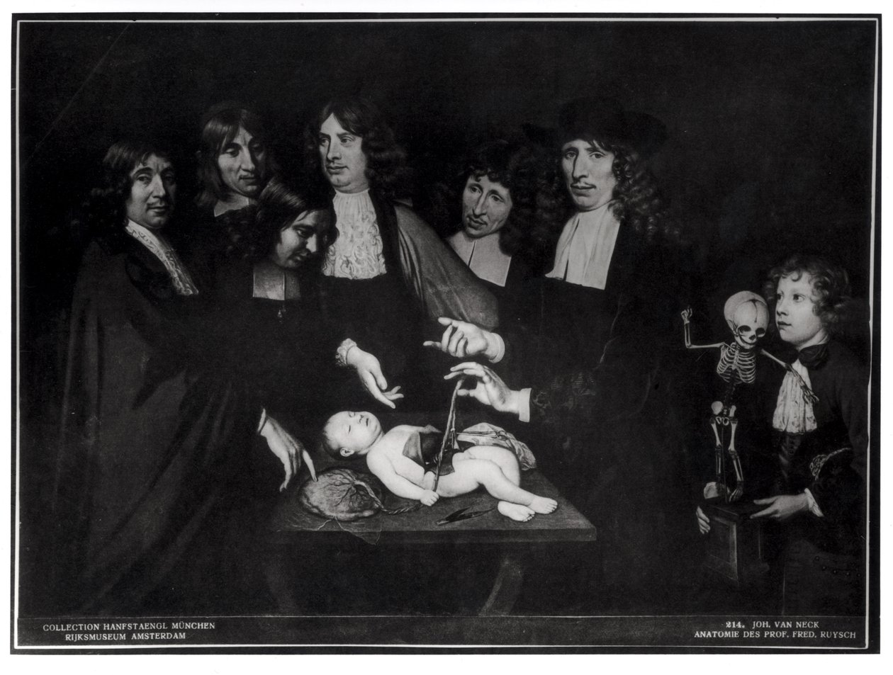 The Anatomy Lesson of Professor Frederik Ruysch by Jan van Neck