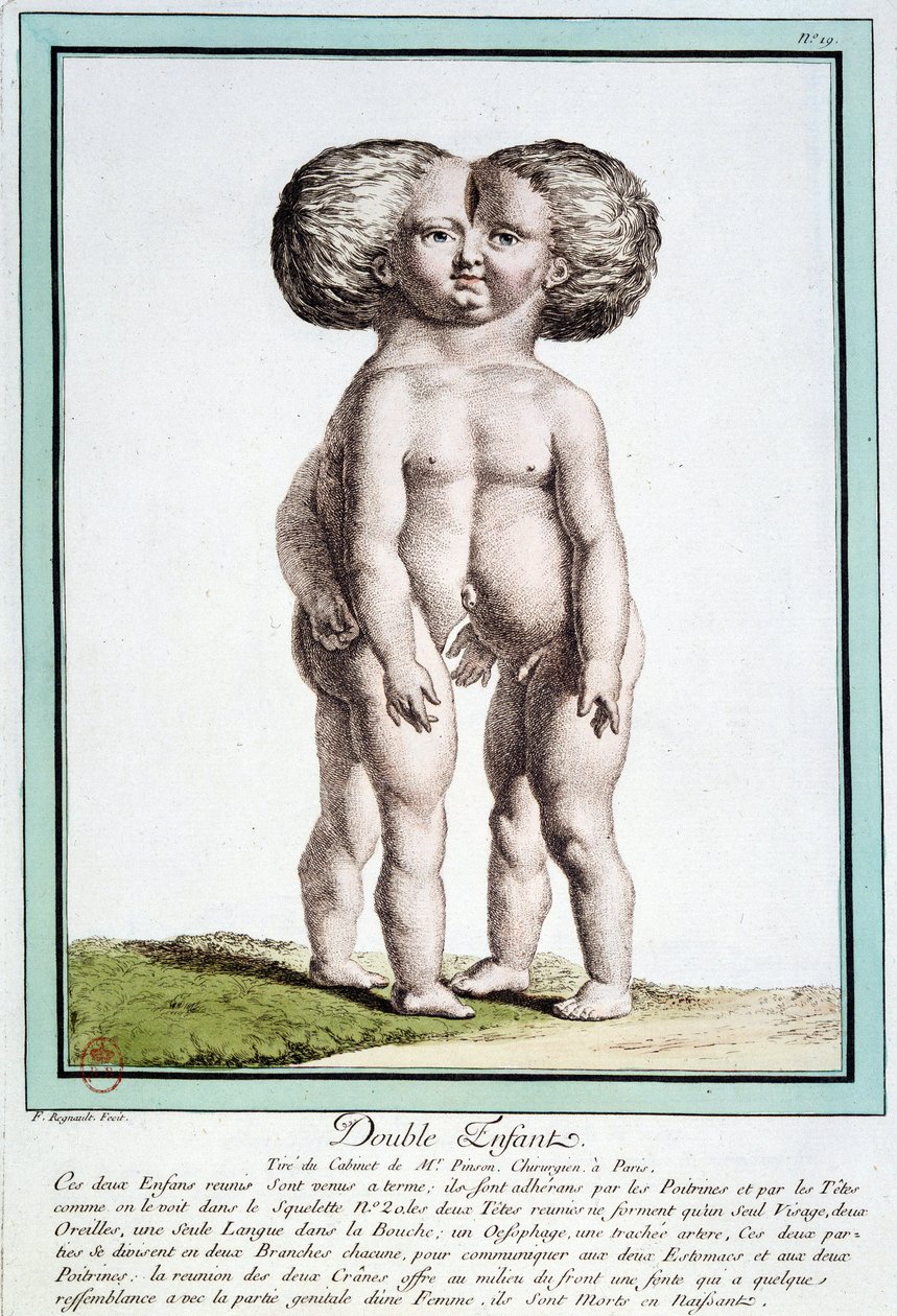 Siamese Children - in 