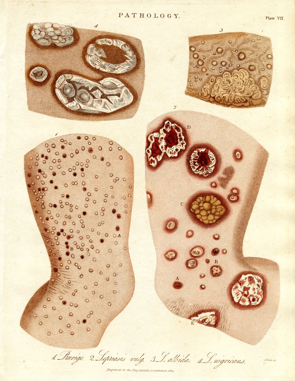 Pathological Skin Conditions: Schurigie, Leprous Skin, Pallada and Impetigo by John Pass