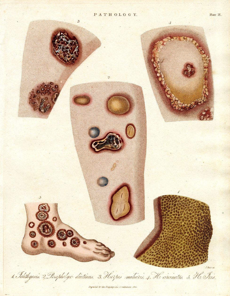 Various Skin Eruptions and Ulcers by John Pass