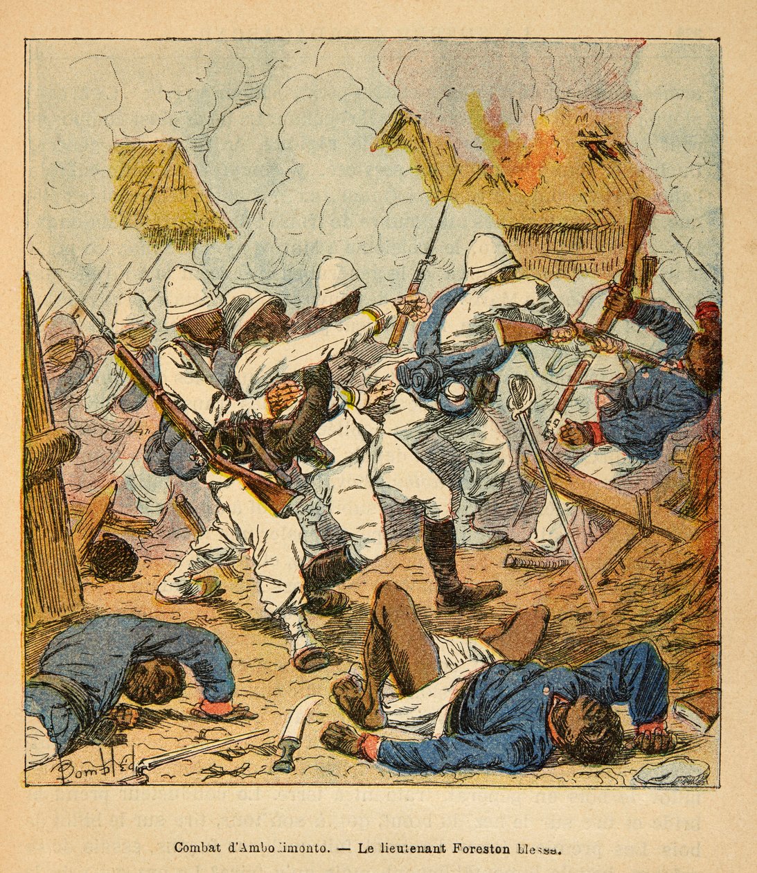 The War in Madagascar: Lieutenant Foreston Wounds During the Battles of Ambolomonty in 1895 by Louis Charles Bombled