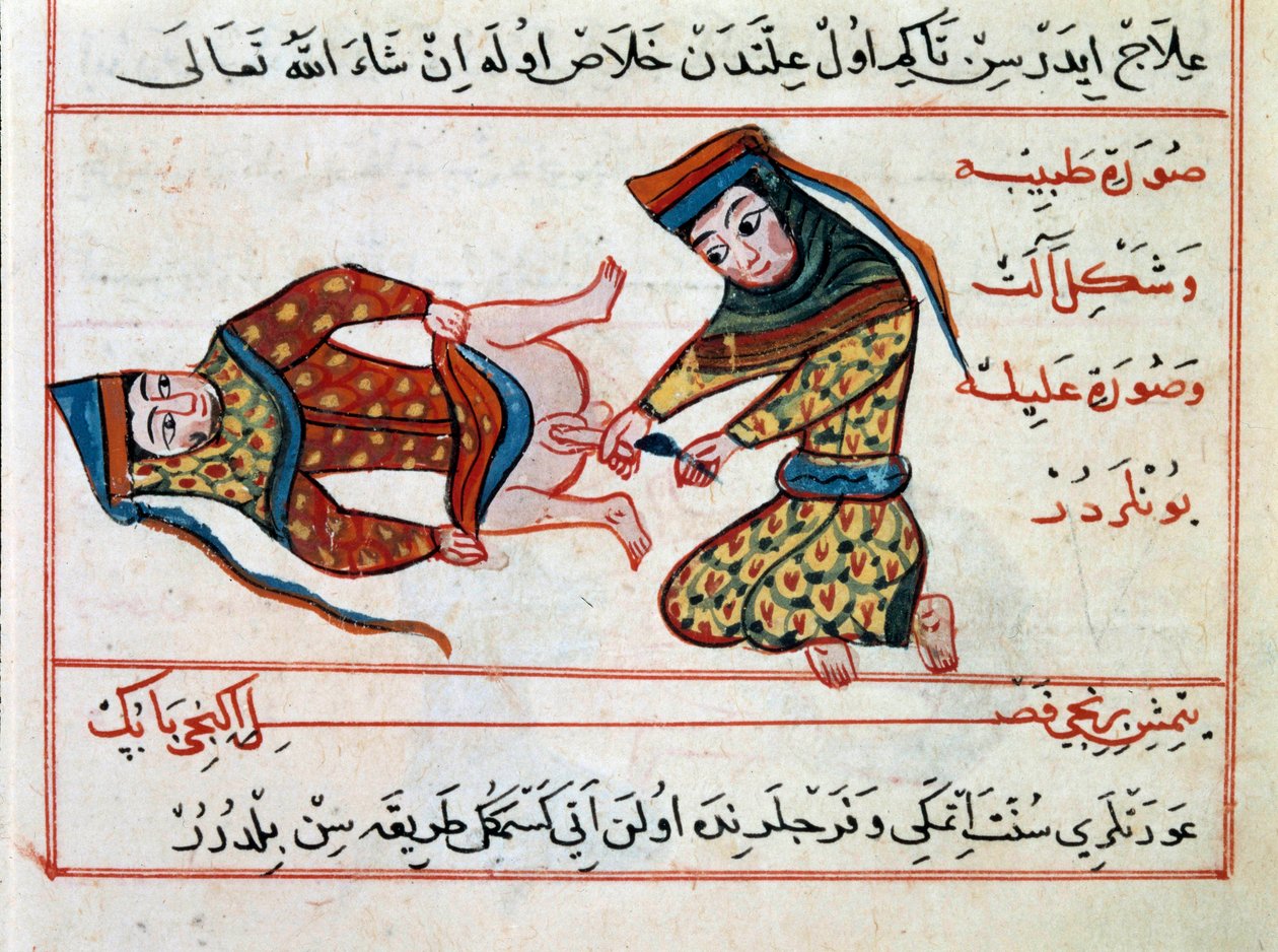 Operation of a hermaphrodite by Ottoman School