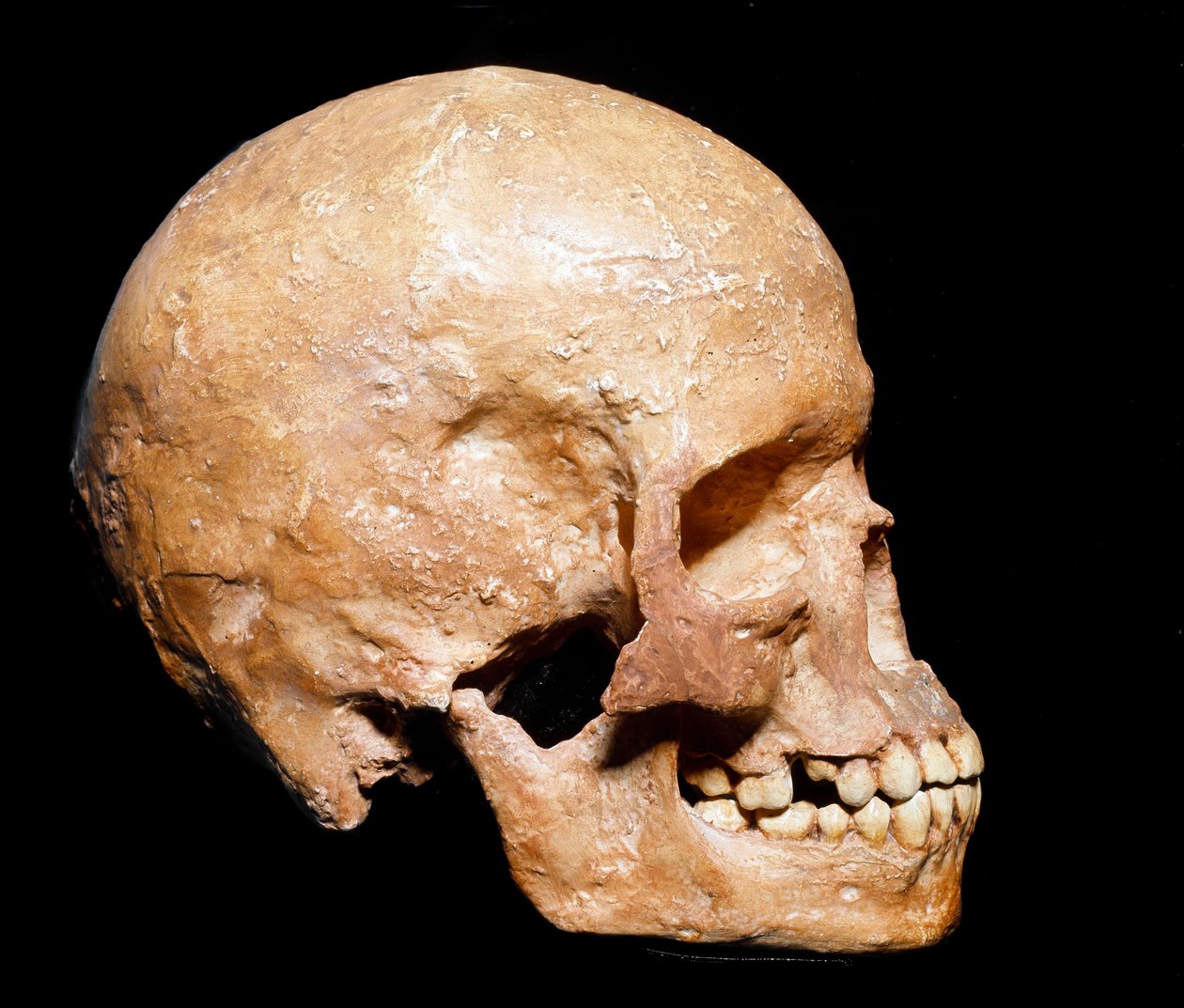 Fossil Skull of Homo Sapiens from Grimaldi by Prehistoric Prehistoric