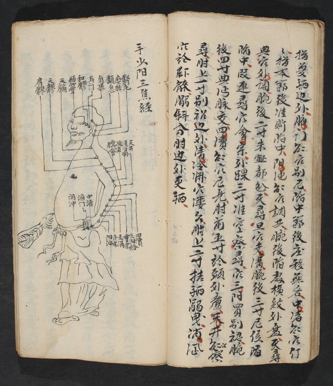 Acupuncture points on the arm, neck and base of the head, from Jing Guan Qi Zhi, 