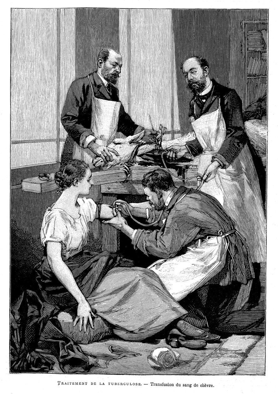 A tuberculosis patient being given a transfusion of goat