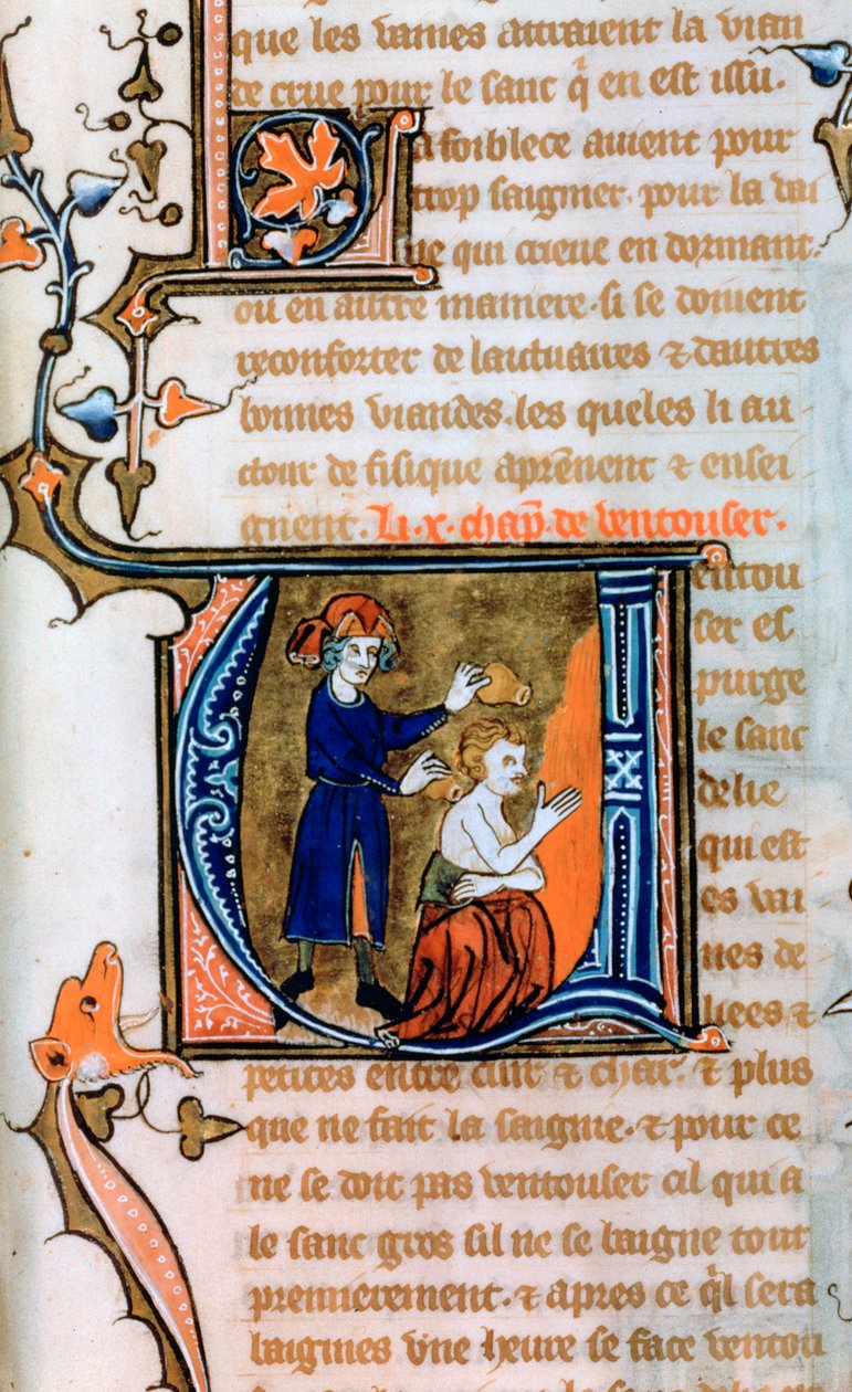 Cupping, 14th Century by Unbekannt