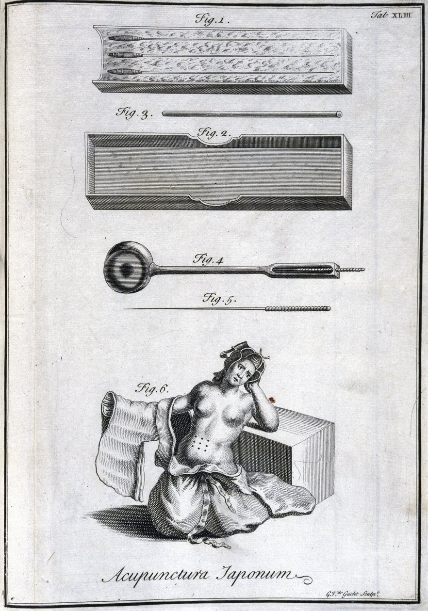 Acupuncture Needles and Their Application, c. 1690, Engraving by G. van der Gucht by Unbekannt
