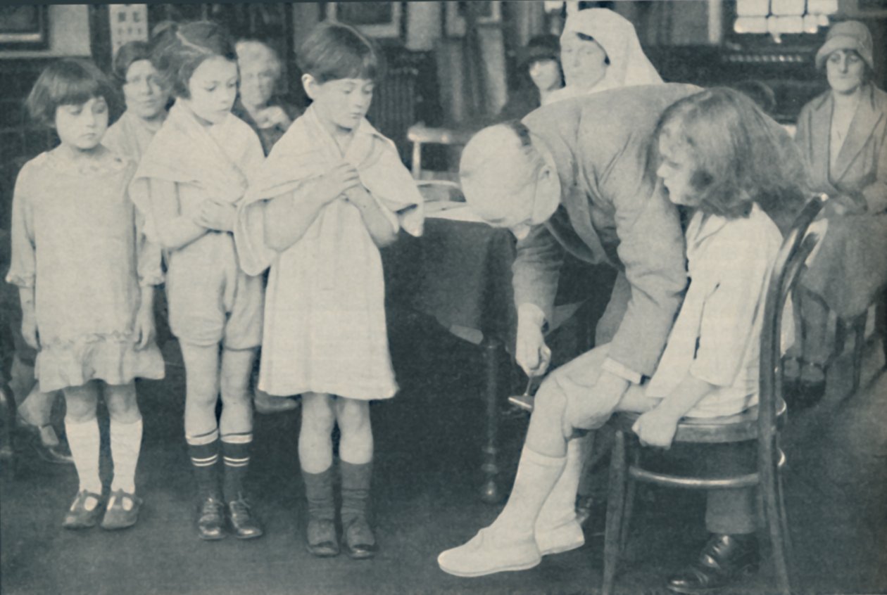Testing the Patella Reflex for Indication of Nervous Disease by Unbekannt