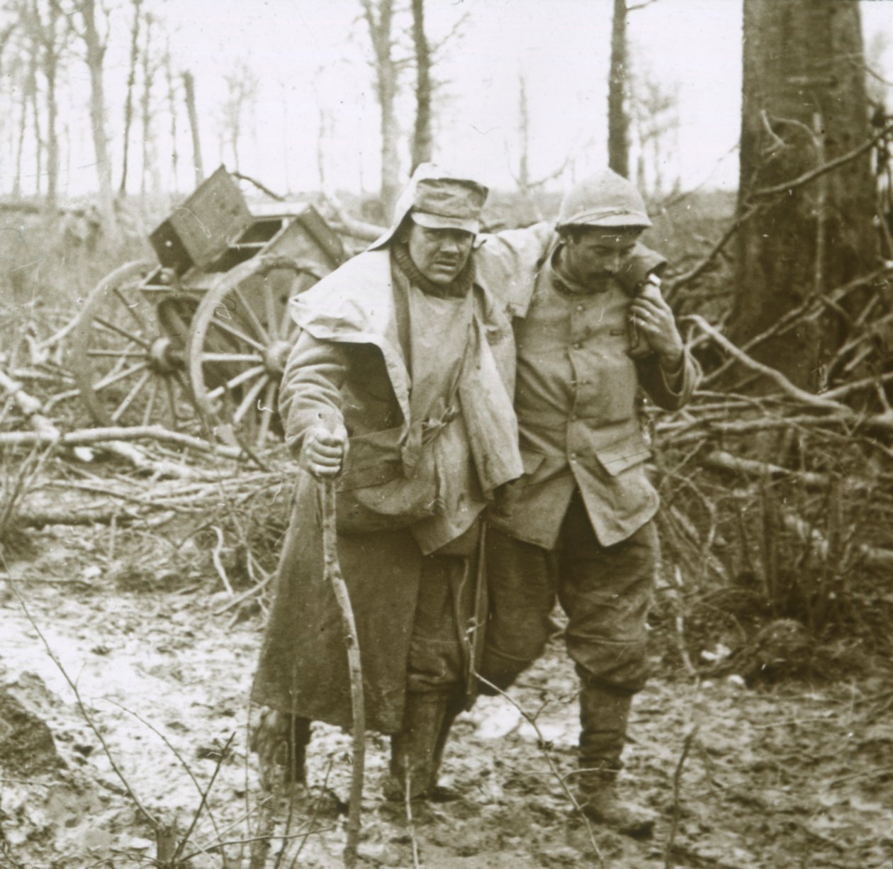 Wounded soldier, Verdun, northern France, 1916 by Unbekannt