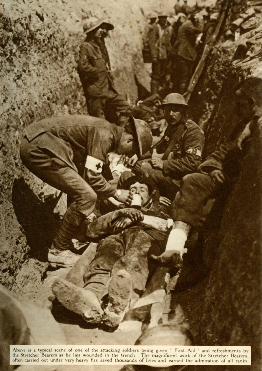 Wounded Soldier Being Treated in the Trenches, Battle of the Somme, First World War, 1916 by Unbekannt